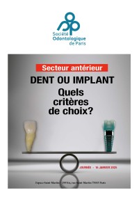 Traitement du secteur antérieur : dent ou implant